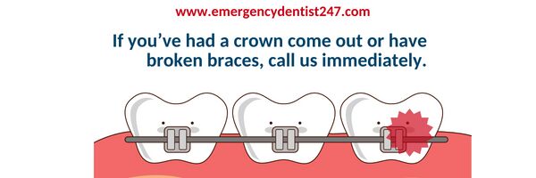 emergency dentist braces