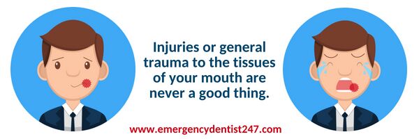 mouth injuries emergency dentist