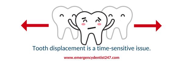 tooth displacement emergency