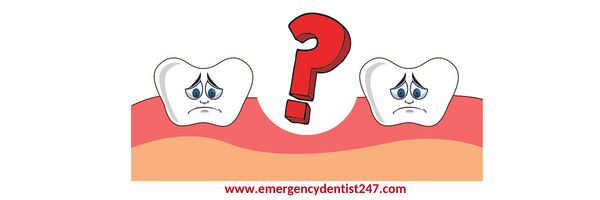 tooth loss emergency dentist