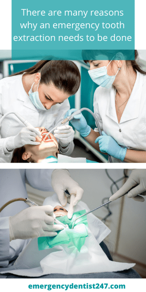 No Dental Insurance Tooth Extraction